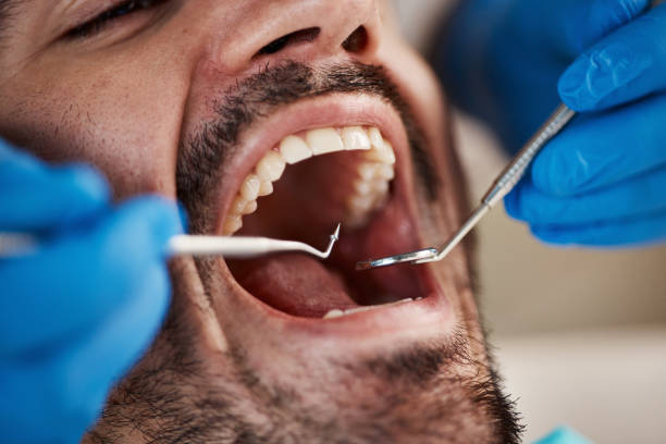 Best Emergency Tooth Extraction in Erie, IL