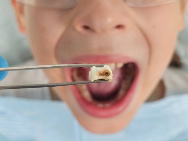 Best Pediatric Emergency Dentist in Erie, IL
