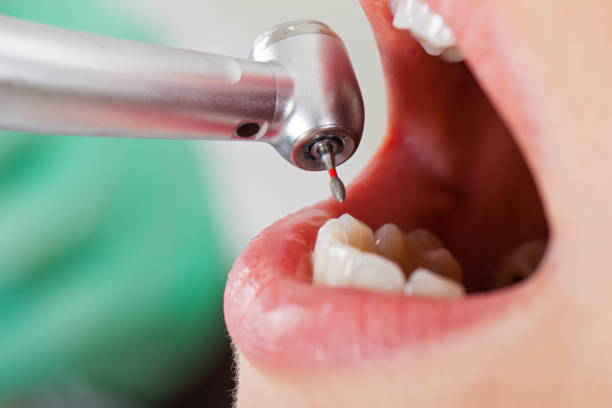 Best Weekend Emergency Dentist in Erie, IL